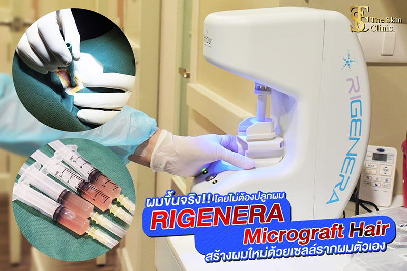 RIGENERA Cell6