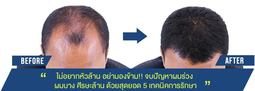before after home