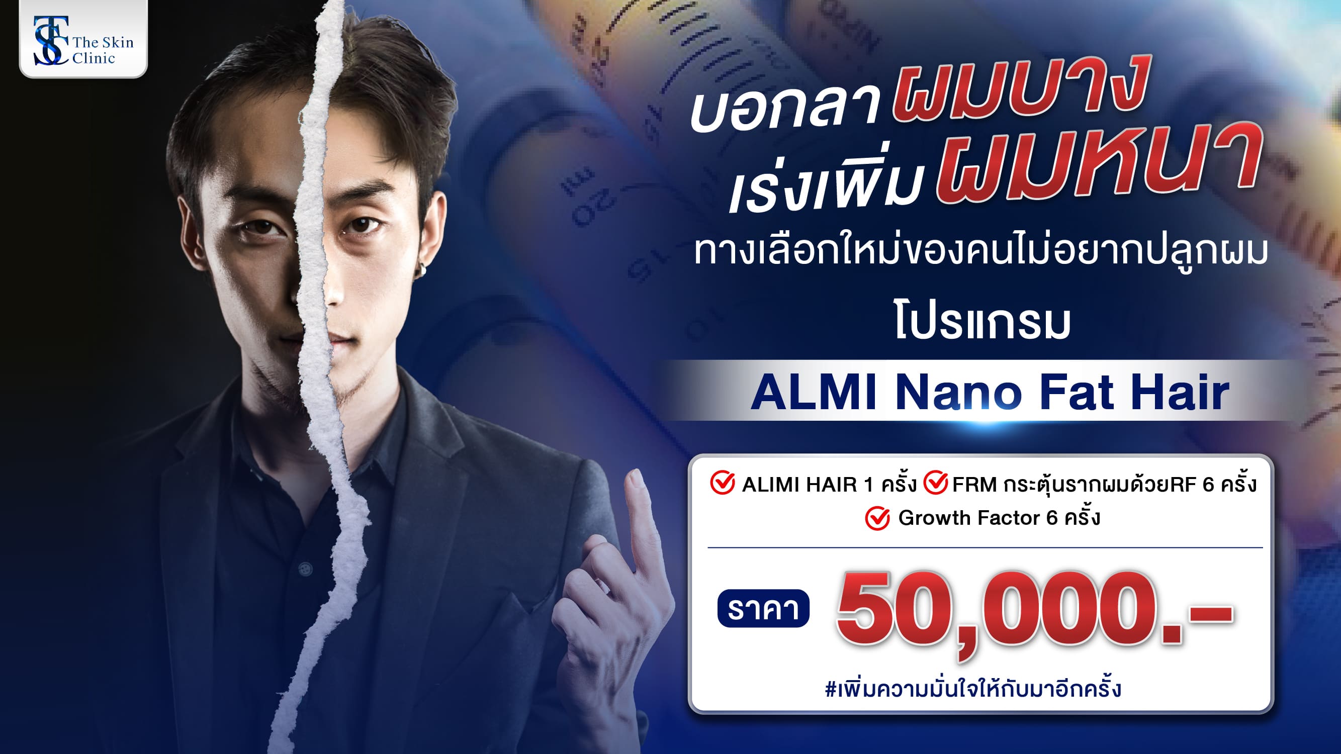 ปลูกผมไร้รอยแผลเย็บ FUE 500-1,000กราฟ เริ่มต้น 50,000 บาท