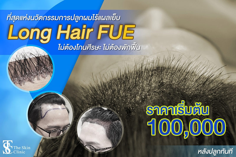 pro long hair fue